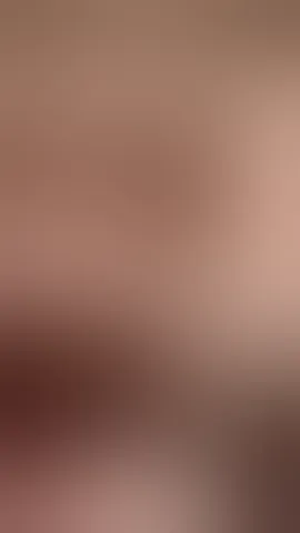 Want some bush?