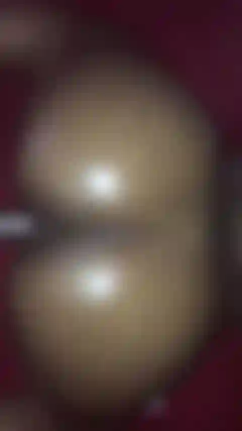 Colpi di schiena oliati.