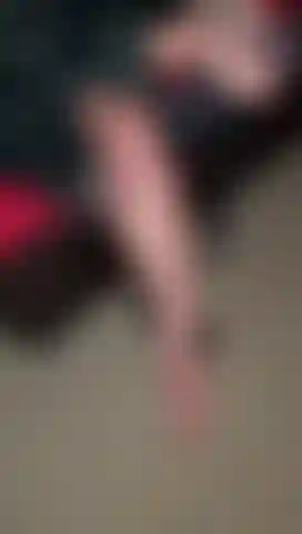 Dressing my naked leg