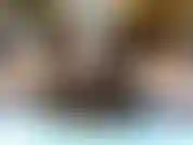 Tratto interno coscia.