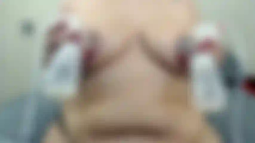 Sessione di estrazione del latte materno.