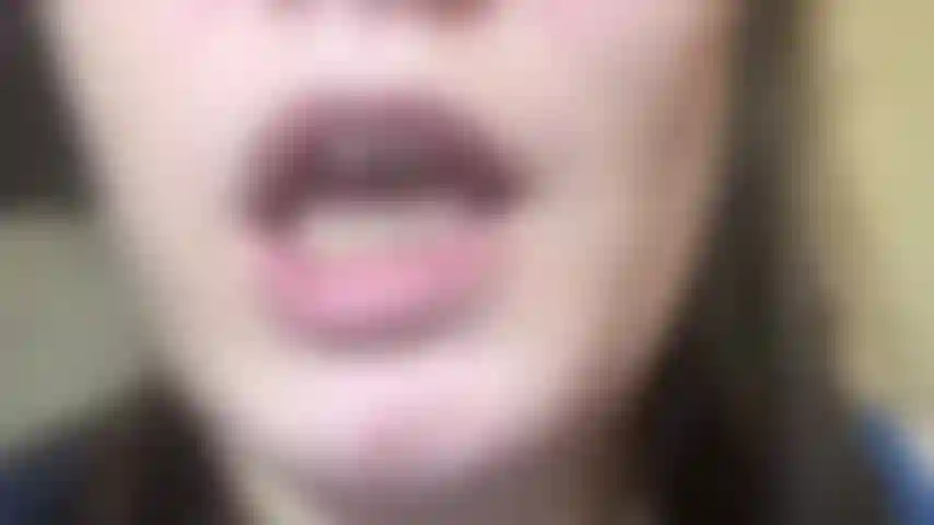 Sputo schiumoso stuzzica.