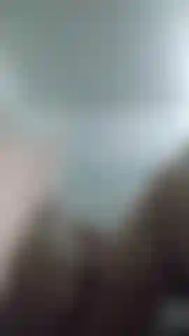 Doppia amputata che gioca con i monconi.